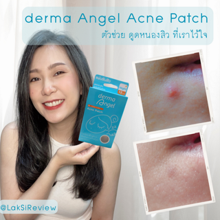 ภาพหน้าปกบทความ:title