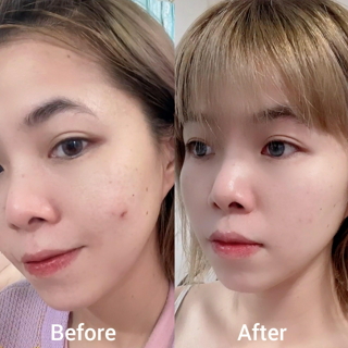 ภาพหน้าปกบทความ:title