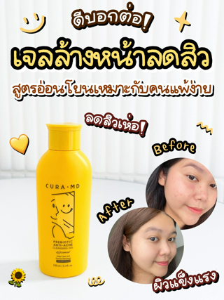 ภาพหน้าปกบทความ:title