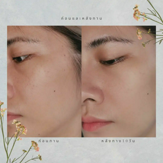 ภาพหน้าปกบทความ:title