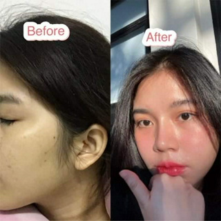 ภาพหน้าปกบทความ:title