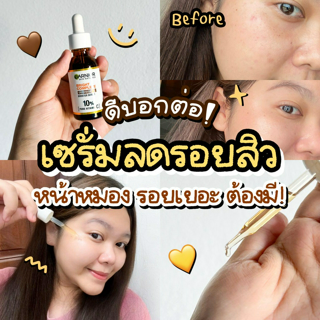 ภาพหน้าปกบทความ:title