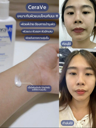 ภาพหน้าปกบทความ:title