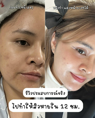 ภาพหน้าปกบทความ:title