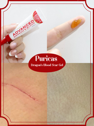 ภาพหน้าปกบทความ:title