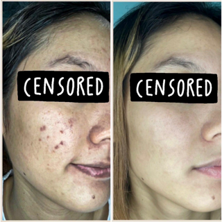 ภาพหน้าปกบทความ:title