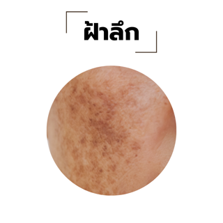 ภาพหน้าปกบทความ:title