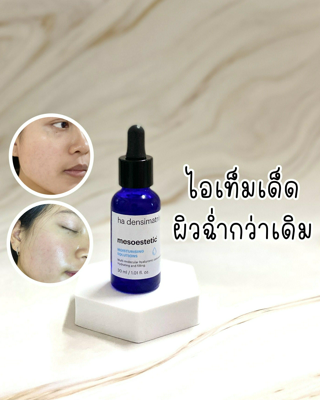 ภาพหน้าปกบทความ:title