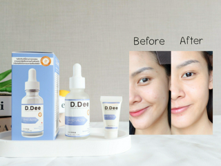 ภาพหน้าปกบทความ:title