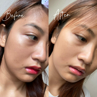 ภาพหน้าปกบทความ:title