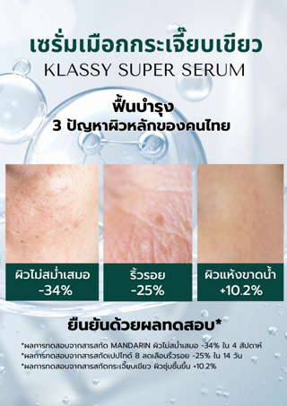 ภาพหน้าปกบทความ:title