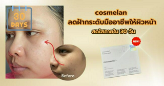 ภาพหน้าปกบทความ:title